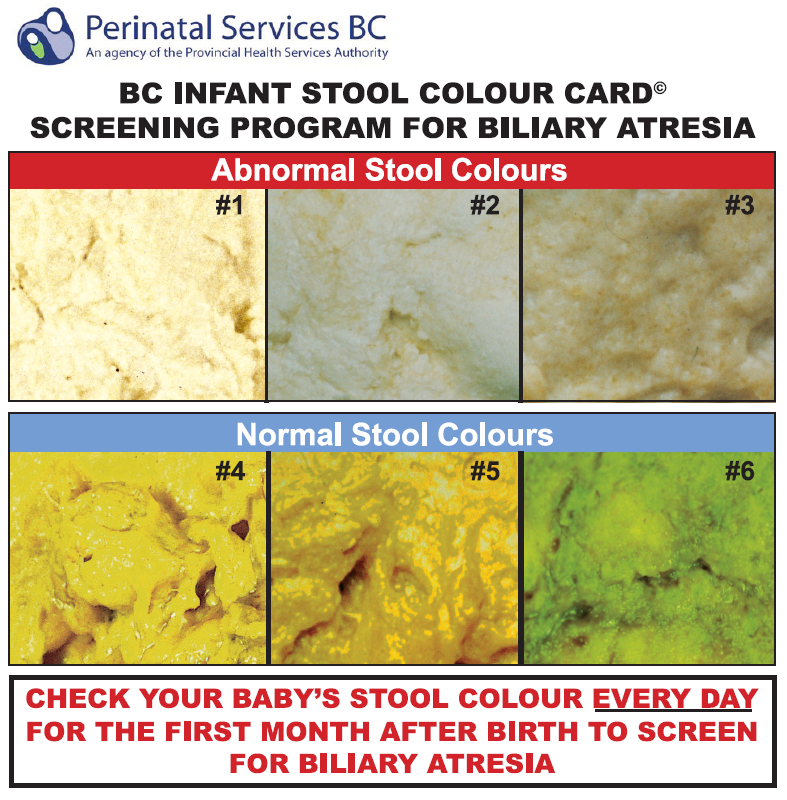 Blanket? Check. Car Seat? Check. Poop colour chart? Huh? - UBC Faculty ...