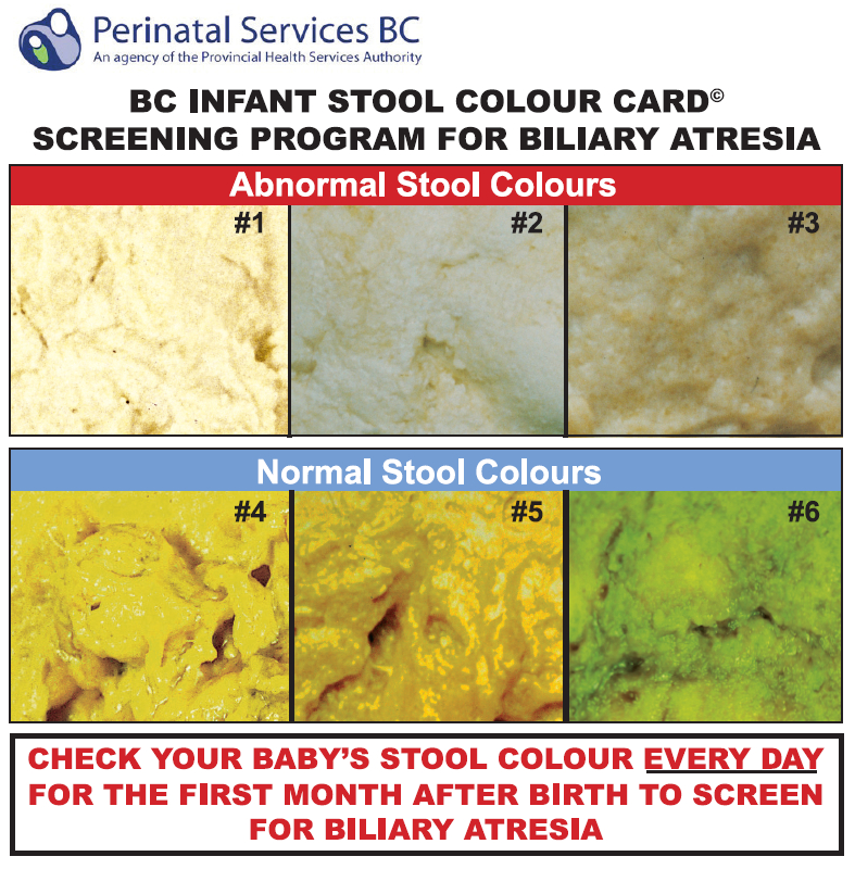 Jaundice Stool Color Chart