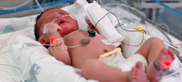 Genetic discovery helps newborns beat a life-threatening condition