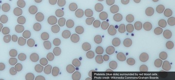 Behold UBC’s latest creation: the “Frankenplatelet”