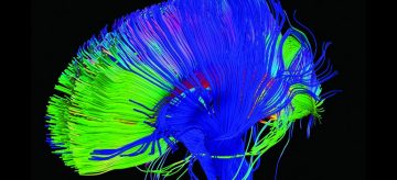 Brain patterns cannot reveal end-of-life decisions for patients with severe brain injuries
