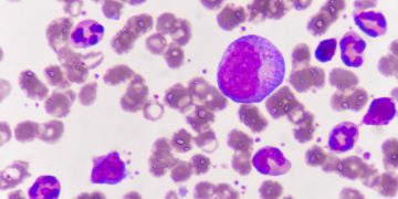 New combination treatment may overcome drug resistance in blood cancers