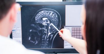 $1.5 million to develop a Canadian brain research strategy
