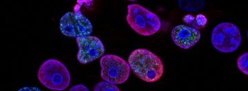 Scientists uncover essential role of one gene in antibody production