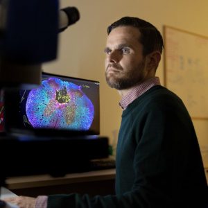 Pushing the boundaries of spinal cord research