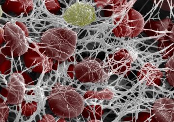 The MPI 8 compound prevents blood clots by targeting polyphosphate, a molecule that accelerates coagulation. (Credit: Kizhakkedathu Research Group)