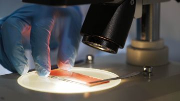 Medical scientist studying blood sample under microscope.