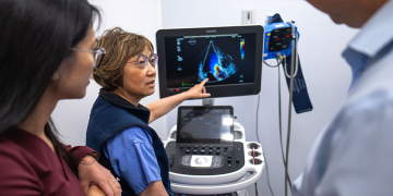 Bringing AI to the Heart of Cardiac Care