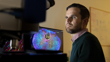 Pushing the boundaries of spinal cord research