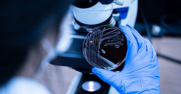 A person in blue gloves holds a petri dish with bacteria under a microscope, ready to analyze it.